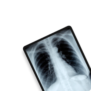 Инструментальные исследования